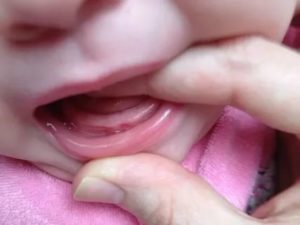 Сиплый голос у ребенка, режутся зубы