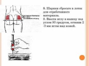 Можно ли поставить внутривенно внутримышечный укол?