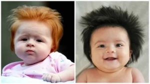 Ребенок родился с волосами