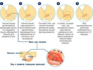 Ребенок укусил сосок