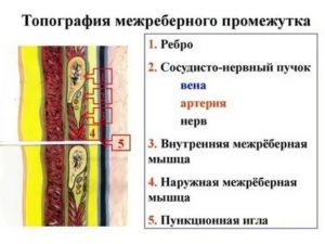 Может ли температура подниматься от невралгии?