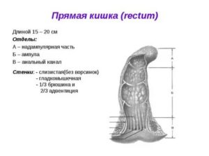 Что делать, если расширена ампула прямой кишки?