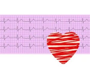 Связь кардиограммы и менструации