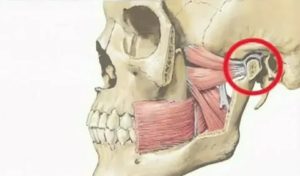 Заплетается язык, болит височно-нижнечелюстный сустав