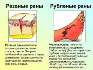 Боль после зажившей резаной раны