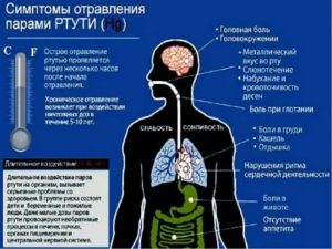 Признаки пары. Симптомы отравления ртутью. Отравление ртутью клиника. При отравлении парами ртути. Признаки при отравлении ртутью.