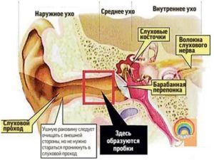 Может ли при серной пробке сильно болеть ухо?