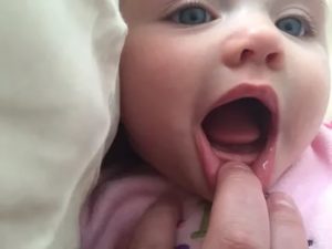 Ребенку 8 месяцев, а зубов нет, почему?