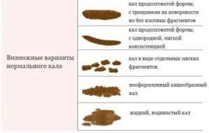 Запоры у ребенка 3 месяцев на ИВ