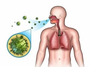 Пневмония и ангина
