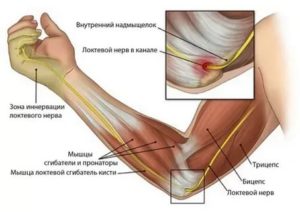 Болят руки в локтевых сгибах