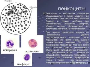 Кашель с мокротой, повышены эозинофилы