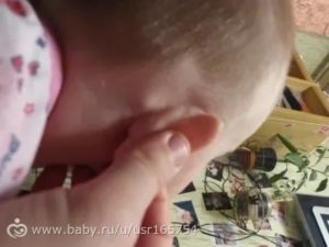 Головалый ребенок чешет, трогает уши