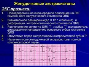 Бывает ли аритмия при ВСД?