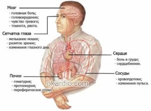 Повышенное давление, боли в сердце