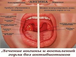 Температура, кашель у ребенка, горло красное