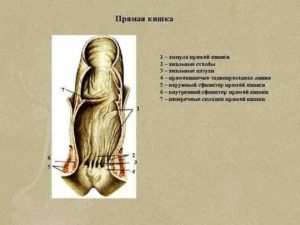 Что делать, если расширена ампула прямой кишки?