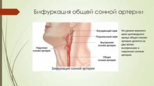 Уплотнение в области сонной артерии