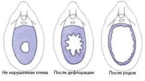 Задержка после потери девственности