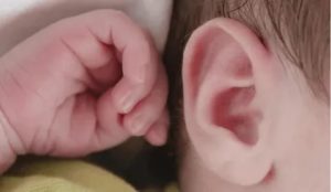 Головалый ребенок чешет, трогает уши