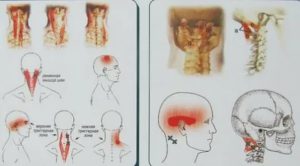 Стала болеть голова при напряжении