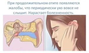 Шум в и заложенность уха при гайморите