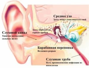 При глотании закладывает уши