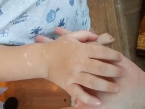 Почему у ребенка белые руки?