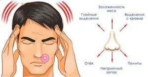 Давление в носовых пазухах, головные боли, что делать?