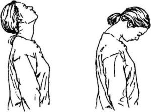 Ребенок втягивает голову в плечи или к одному плечу
