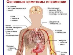 Может ли воспаление легких  или бронхит протекать без температуры?