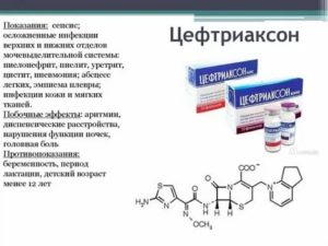 Можно ли смешивать физраствор Дексаметазон и Цефтриаксон?