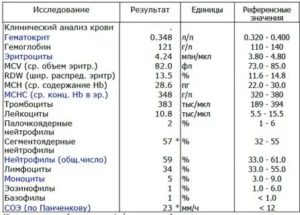 Стоит ли принимать антибиотик без анализа крови?