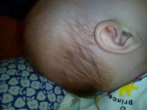 Ребенок в 3 месяца сильно потеет