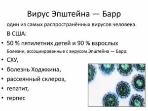 У ребенка нашли вирус Эпштейна-Барр