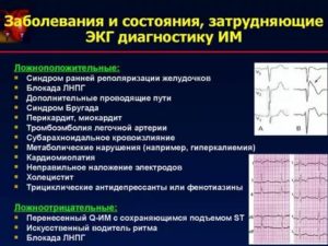 Может ли ЭКГ прояснить ситуацию?