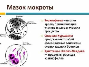 Кашель с мокротой, повышены эозинофилы