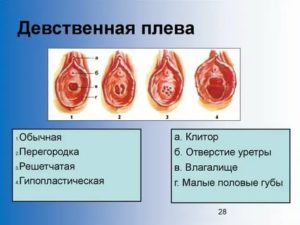 Вопрос по безболезненной дефлорации