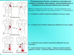 Боли в одной точке поясницы