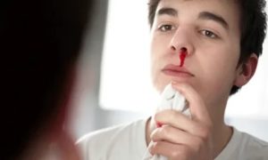 Из носа идёт кровь, к какому врачу обратиться?