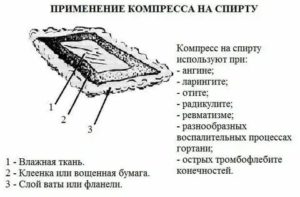 Можно ли делать спиртовой компресс при температуре?