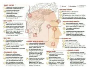 Может ли из за зуба быть пульсация в висках и головокружение?