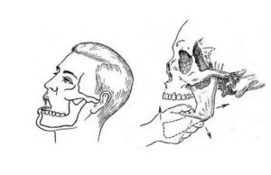 Плохо открывается челюсть