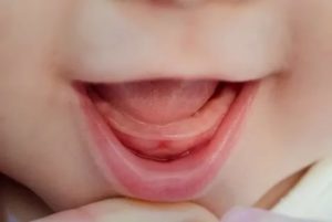 Можно ли гулять с ребенком, когда лезут зубы?