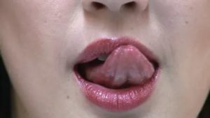 Жжение языка и верхней губы после орального секса