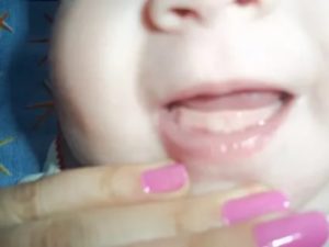 У ребенка в 10 месяцев нет зубов