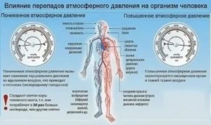 Могут ли при повышенном атмосферном давлении быть головокружения?