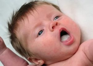 Сухость во рту у новорожденного