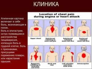 Колет под правой грудью, что это может быть?