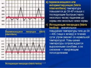 У ребенка поднимается к вечеру температура